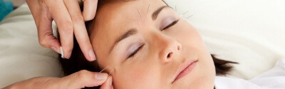 cosmetic acupuncture